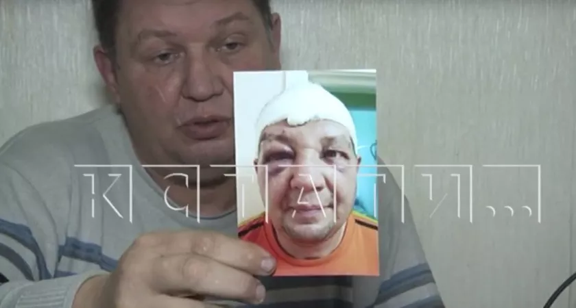Фото к статье: В Арзамасе избитый пьяными "зайцами" водитель автобуса не может добиться справедливости