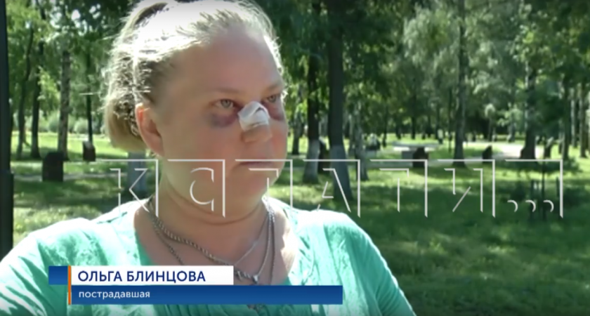 Жительнице Автозаводского района сломали нос, когда она пришла за помощью в ТСЖ 