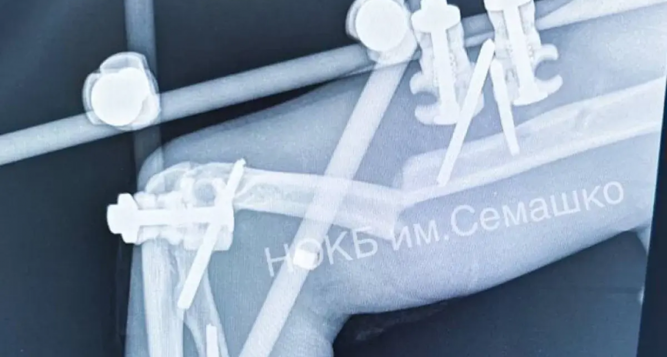 Чудо в Нижнем Новгороде: строитель выжил после падения с 32-го этажа