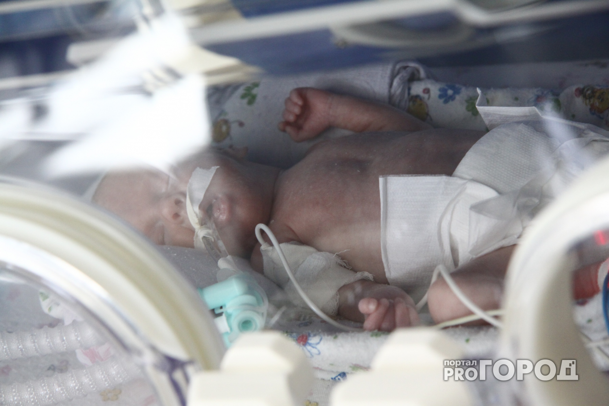 Трехнедельную малютку, которую обожгли в больнице, прооперировали: новые подробности