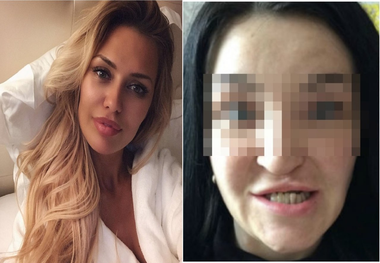 Нижегородка с дефектом лица обвинила экс-участницу «Дом-2» Викторию Боню в обмане