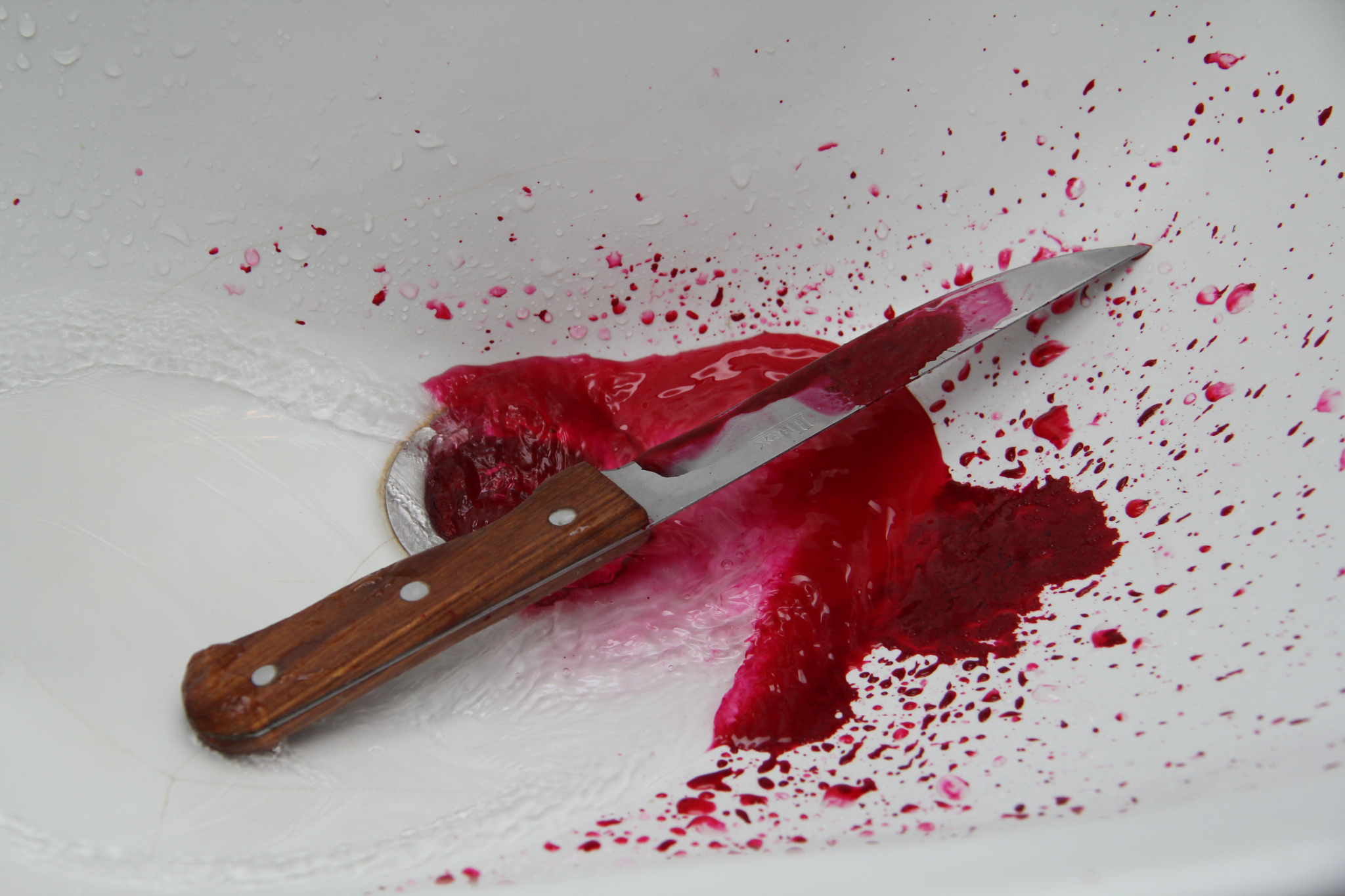 37-летний нижегородец ударил свою любовницу ножом из ревности