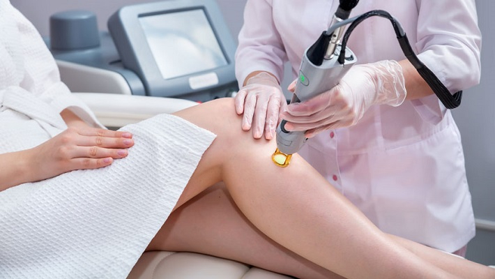 Лазерная эпиляция