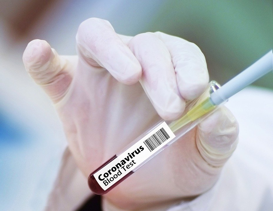 Названы категории нижегородцев, которые обязаны пройти обследование на коронавирус