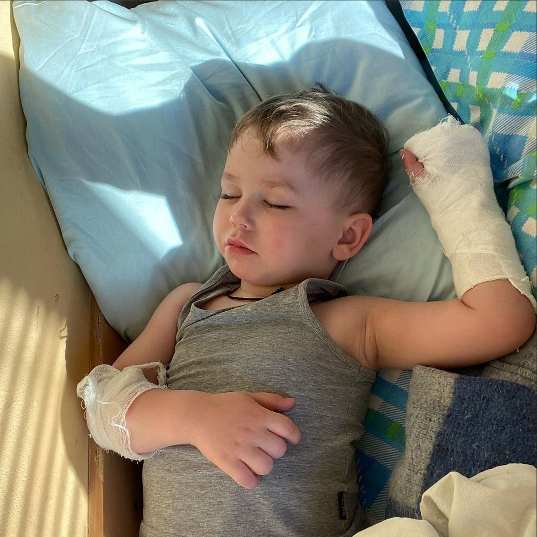 В истории малыша, которому в детсаду оторвало часть пальца, поставили точку