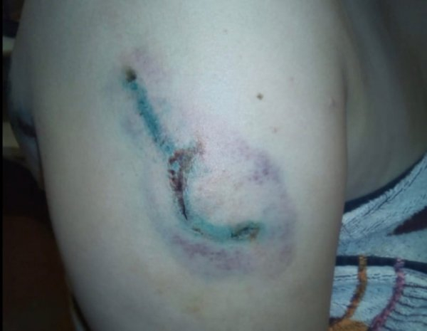 В День города женщина покусала полицейского, желая попасть на представление