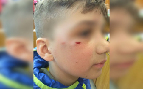 Появилось видео с моментом нападения собаки на мальчика на Бору