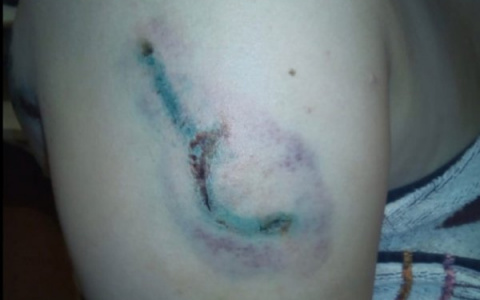 В День города женщина покусала полицейского, желая попасть на представление