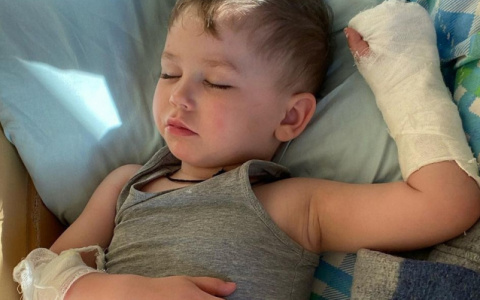 История с малышом, лишившегося пальца в детсаду Приокского района, решилась не в его пользу