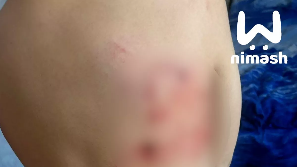 В Кулебаках собака сорвалась с цепи и напала на ребенка