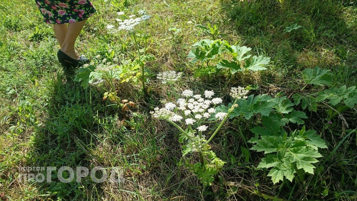 Пять жителей Нижегородской области получили химические ожоги от борщевика с начала мая 2026 года