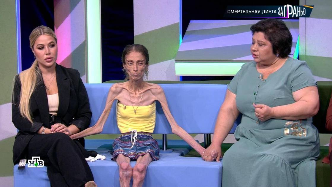 Нижегородские медики спасают самую худую девушку в мире