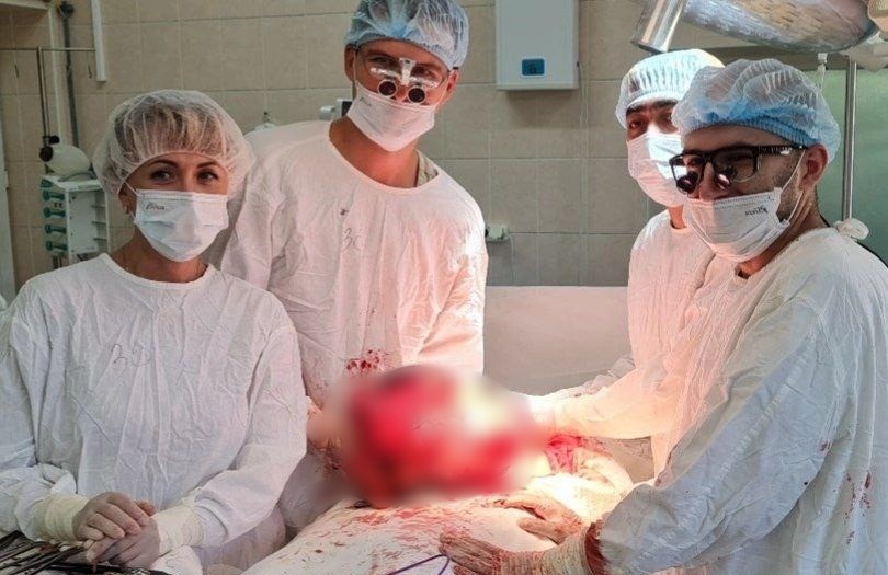 Нижегородские врачи удалили опухоль весом 9 килограмм