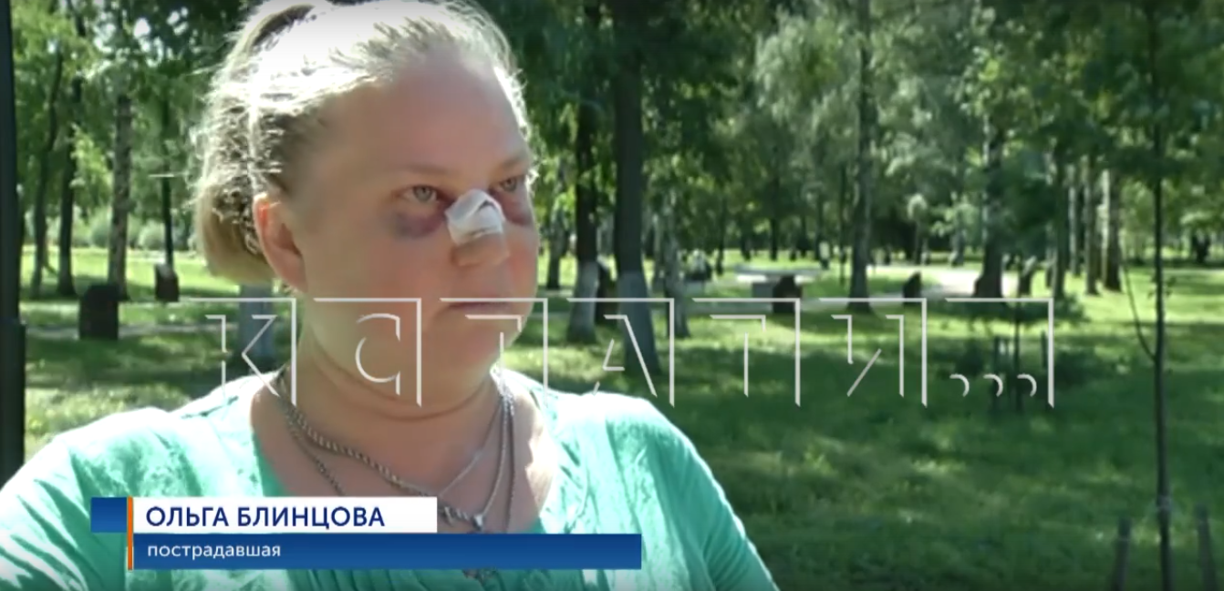 Жительнице Автозаводского района сломали нос, когда она пришла за помощью в ТСЖ 