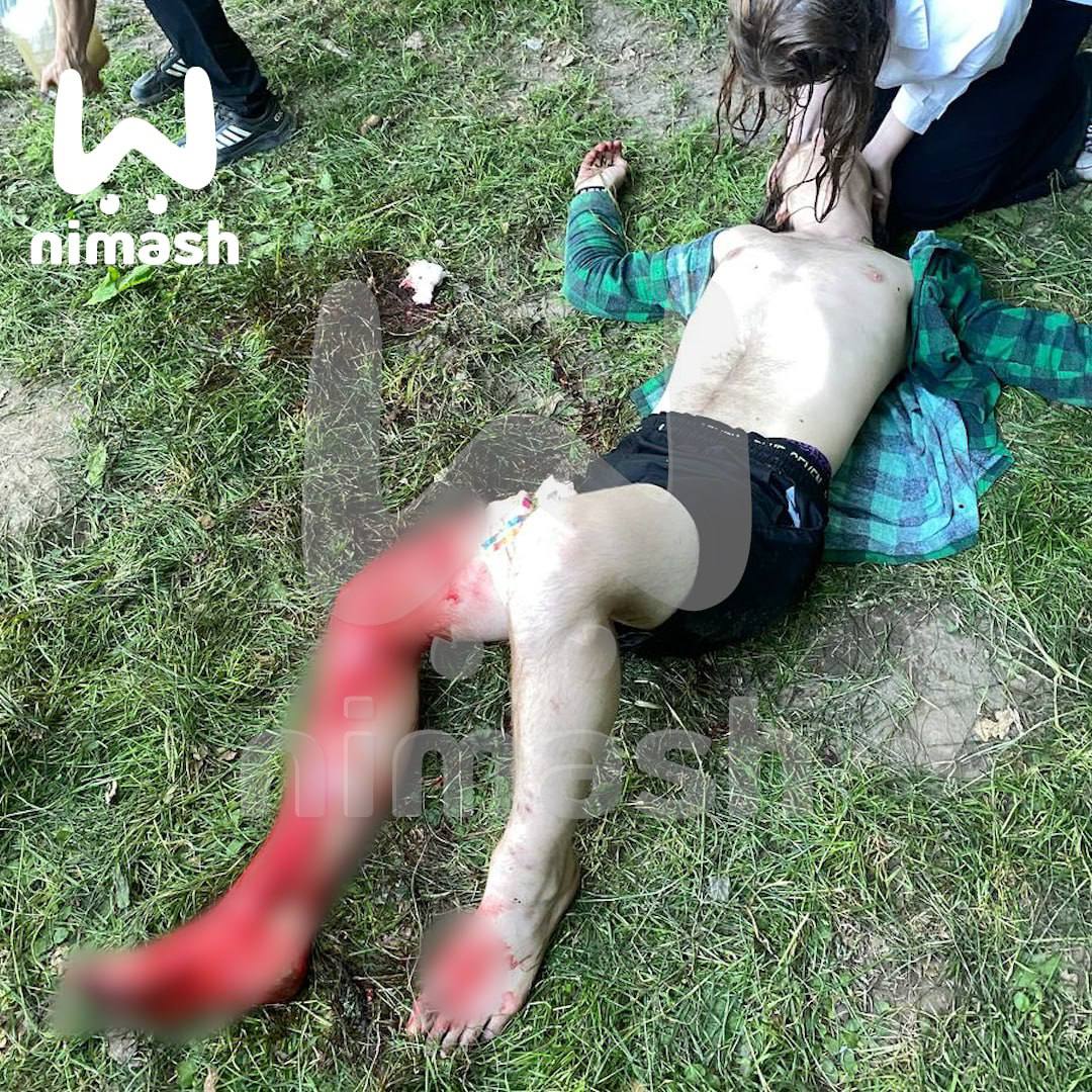 Появились новые подробности о нападении с ножом на парня в Щелковском хуторе